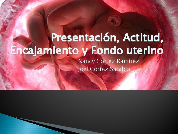 Presentación, Actitud, Encajamiento y Fondo uterino Nancy Cortez Ramírez Joel Cortez Sarabia 