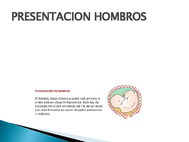 PRESENTACION HOMBROS 