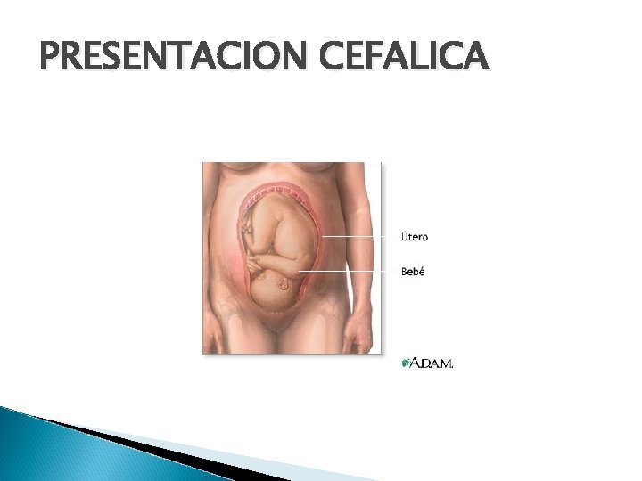 PRESENTACION CEFALICA 