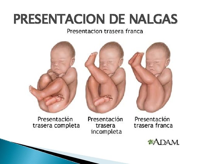 PRESENTACION DE NALGAS 