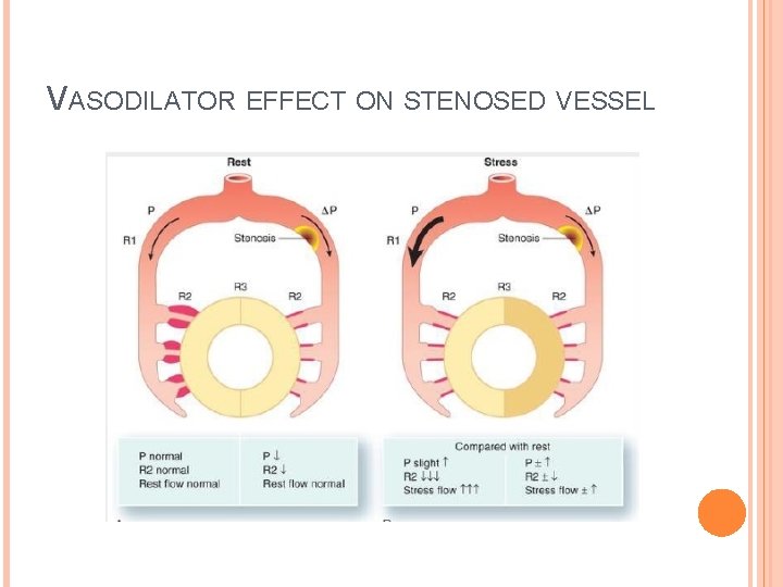 VASODILATOR EFFECT ON STENOSED VESSEL 