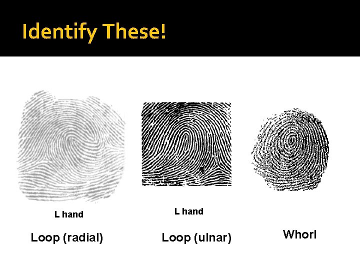 Identify These! L hand Loop (radial) L hand Loop (ulnar) Whorl 