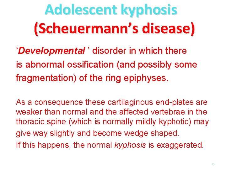 Adolescent kyphosis (Scheuermann’s disease) ‘Developmental ’ disorder in which there is abnormal ossification (and