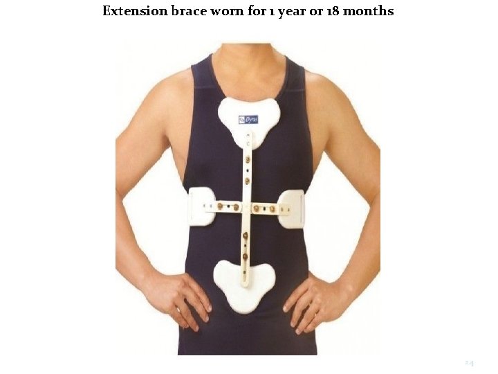 Extension brace worn for 1 year or 18 months 24 