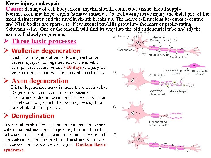Nerve injury and repair Cause: damage of cell body, axon, myelin sheath, connective tissue, Nerve injury and repair Cause: damage of cell body, axon, myelin sheath, connective tissue,