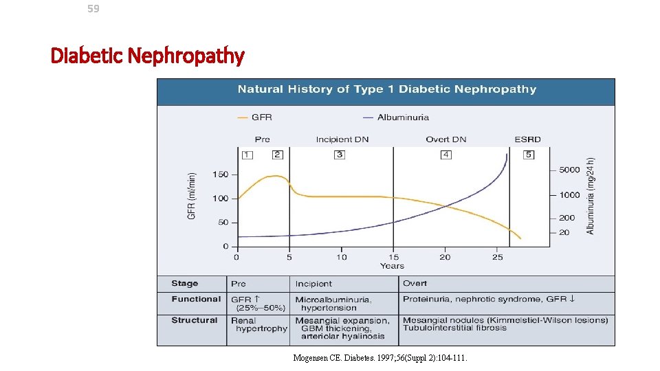 59 Diabetic Nephropathy Mogensen CE. Diabetes. 1997; 56(Suppl 2): 104 -111. 