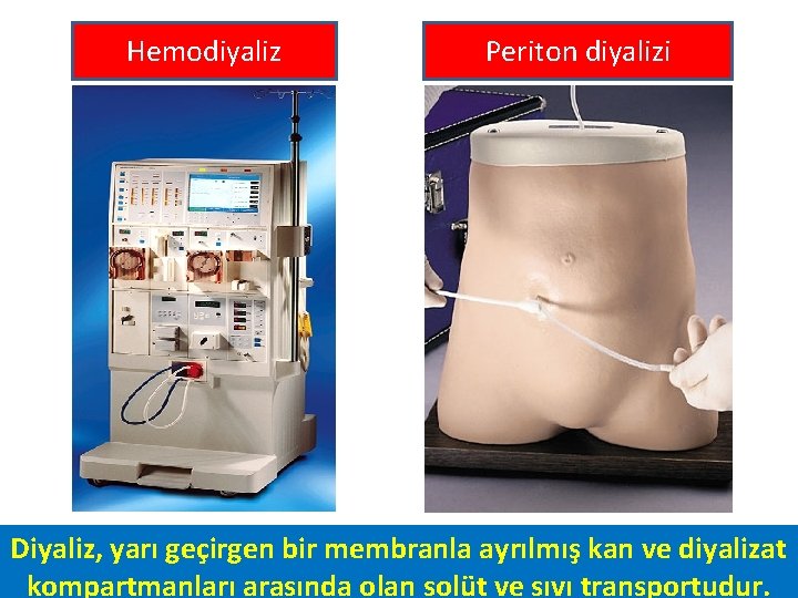 Hemodiyaliz Periton diyalizi Diyaliz, yarı geçirgen bir membranla ayrılmış kan ve diyalizat kompartmanları arasında