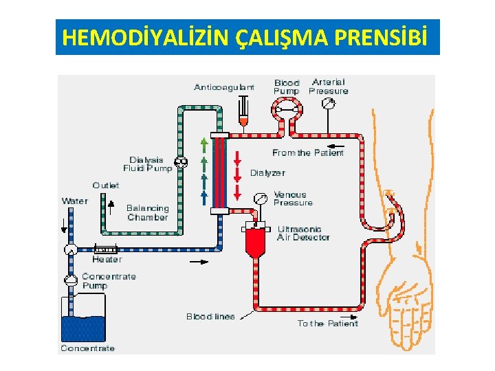 HEMODİYALİZİN ÇALIŞMA PRENSİBİ 