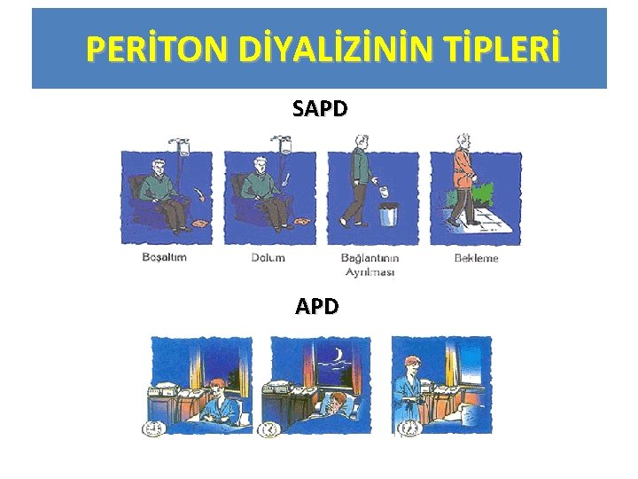 PERİTON DİYALİZİNİN TİPLERİ SAPD 