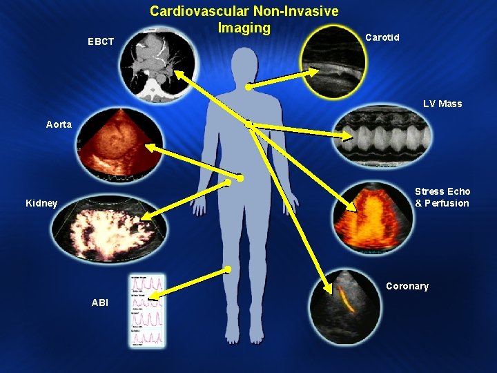 Cardiovascular Non-Invasive Imaging EBCT Carotid LV Mass Aorta Stress Echo & Perfusion Kidney Coronary