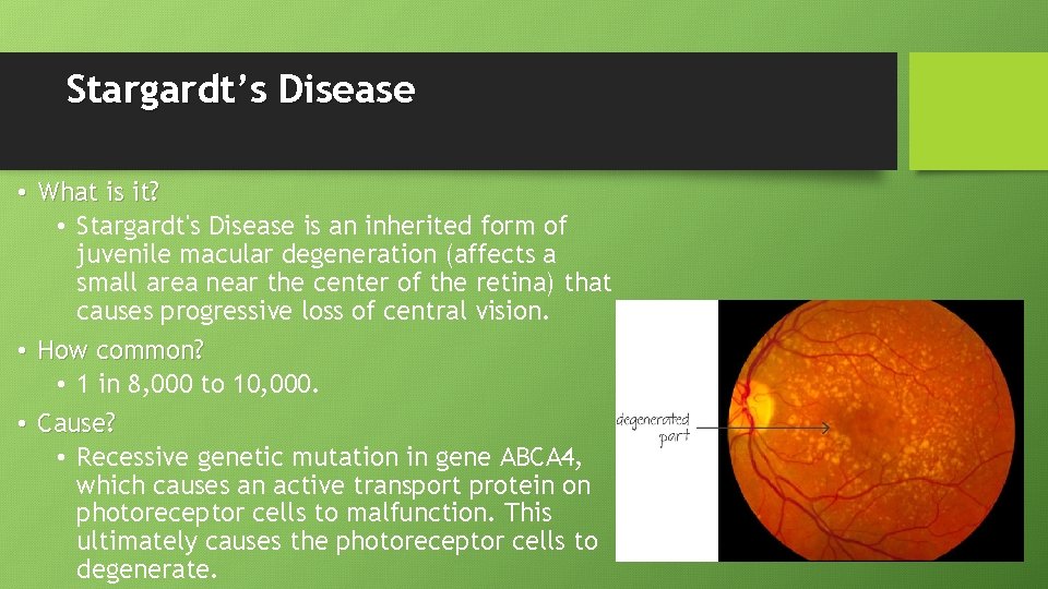 Stargardt’s Disease • What is it? • Stargardt's Disease is an inherited form of