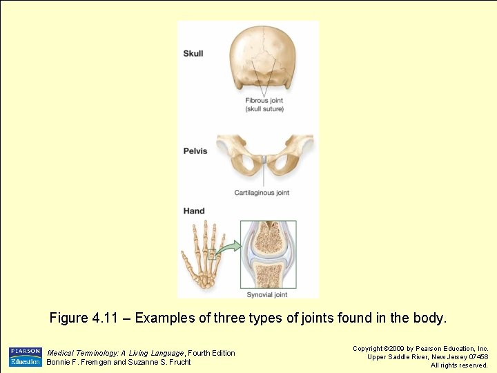 Figure 4. 11 – Examples of three types of joints found in the body.