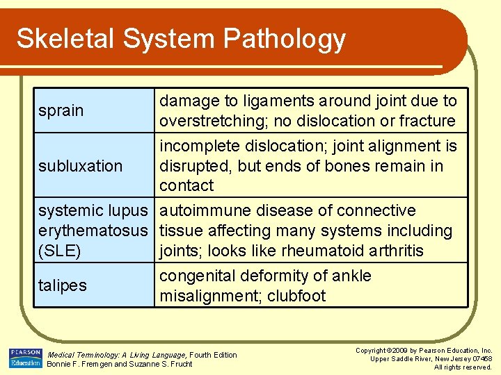 Skeletal System Pathology sprain damage to ligaments around joint due to overstretching; no dislocation
