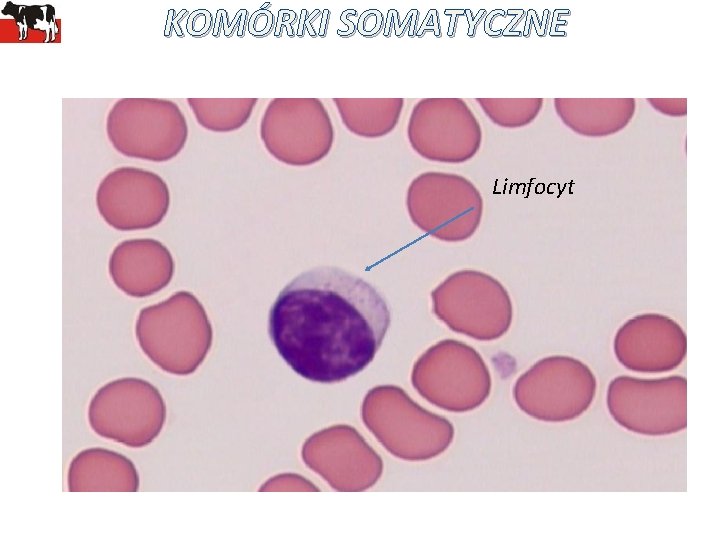 KOMÓRKI SOMATYCZNE Limfocyt 