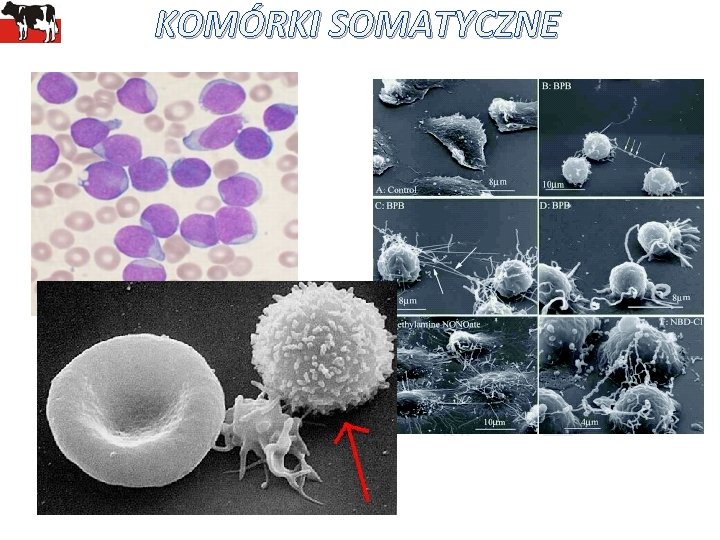 KOMÓRKI SOMATYCZNE 