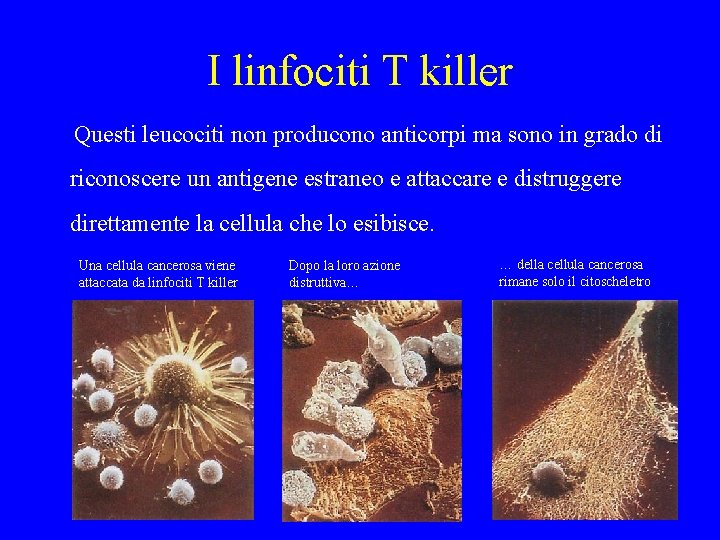 I linfociti T killer Questi leucociti non producono anticorpi ma sono in grado di