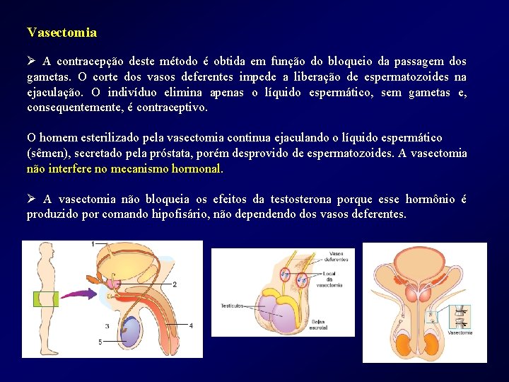Vasectomia Ø A contracepção deste método é obtida em função do bloqueio da passagem