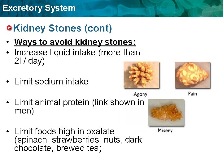 Excretory System Kidney Stones (cont) • Ways to avoid kidney stones: • Increase liquid