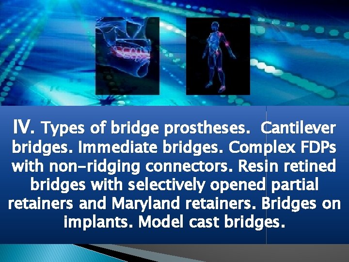 IV. Types of bridge prostheses. Cantilever bridges. Immediate bridges. Complex FDPs with non-ridging connectors.
