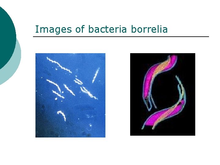 Images of bacteria borrelia 