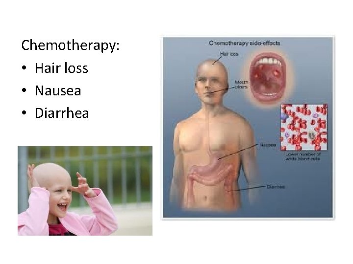 Chemotherapy: • Hair loss • Nausea • Diarrhea Chemotherapy: • Hair loss • Nausea • Diarrhea