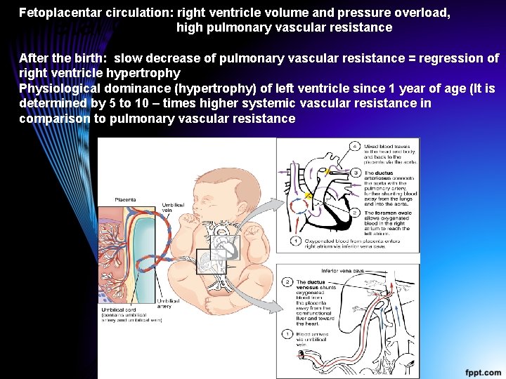 Fetoplacentar circulation: right ventricle volume and pressure overload, high pulmonary vascular resistance Fetal circulation