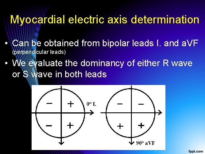 Myocardial electric axis determination • Can be obtained from bipolar leads I. and a.