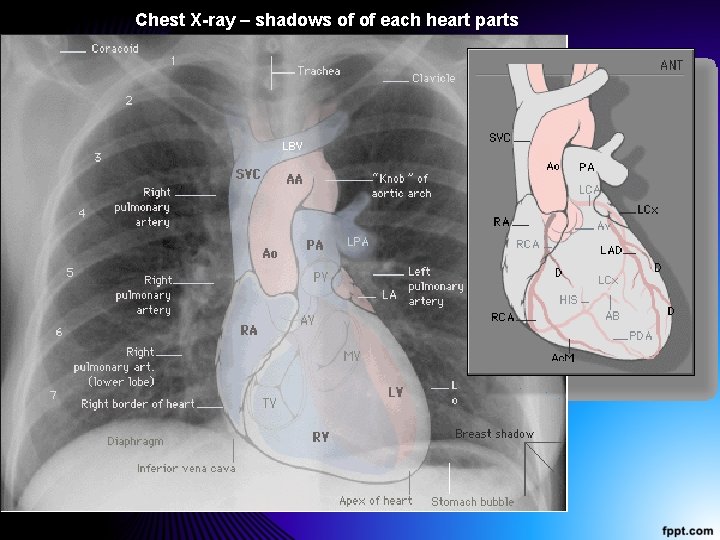 Chest X-ray – shadows of of each heart parts 