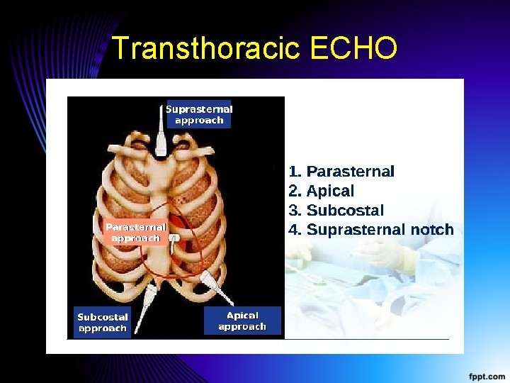 Transthoracic ECHO 