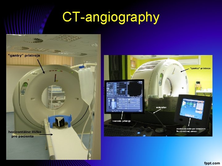 CT-angiography CT-angiography