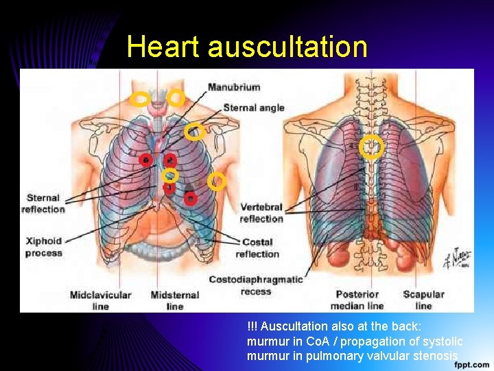 Heart auscultation !!! Auscultation also at the back: murmur in Co. A / propagation Heart auscultation !!! Auscultation also at the back: murmur in Co. A / propagation