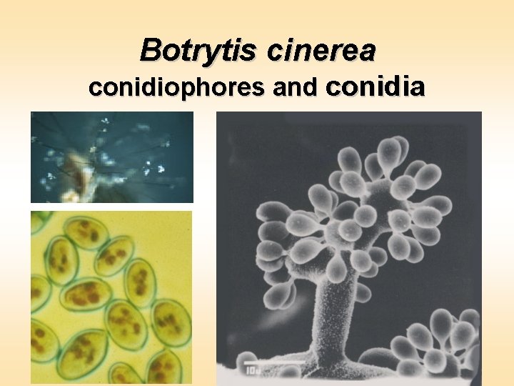 Botrytis cinerea conidiophores and conidia 