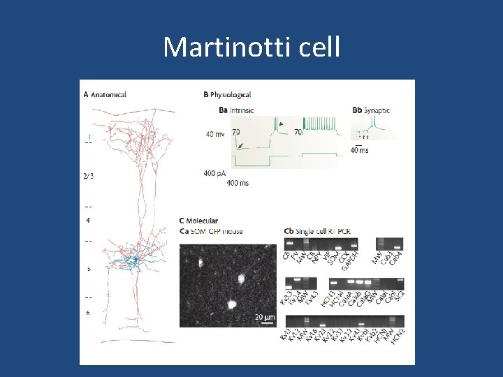 Martinotti cell Martinotti cell