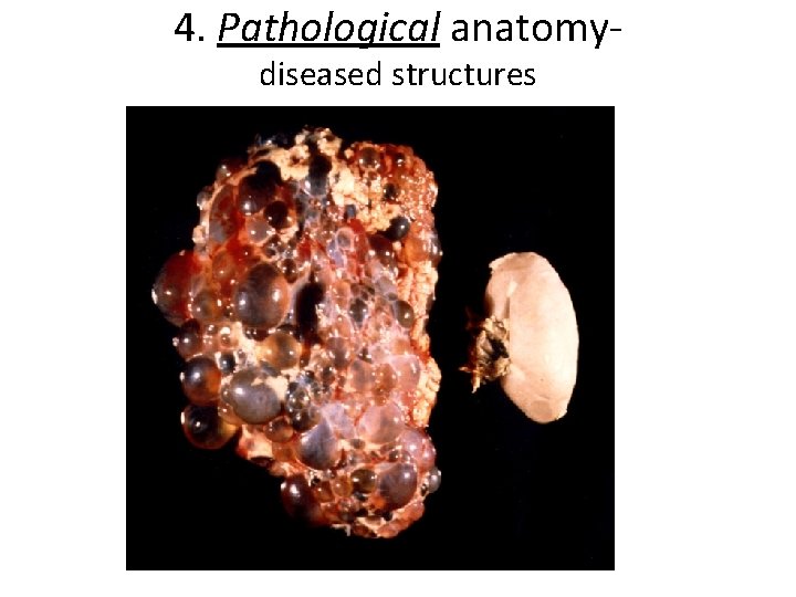 4. Pathological anatomydiseased structures 