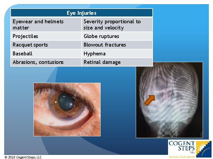 Eye Injuries Eyewear and helmets matter Severity proportional to size and velocity Projectiles Globe Eye Injuries Eyewear and helmets matter Severity proportional to size and velocity Projectiles Globe