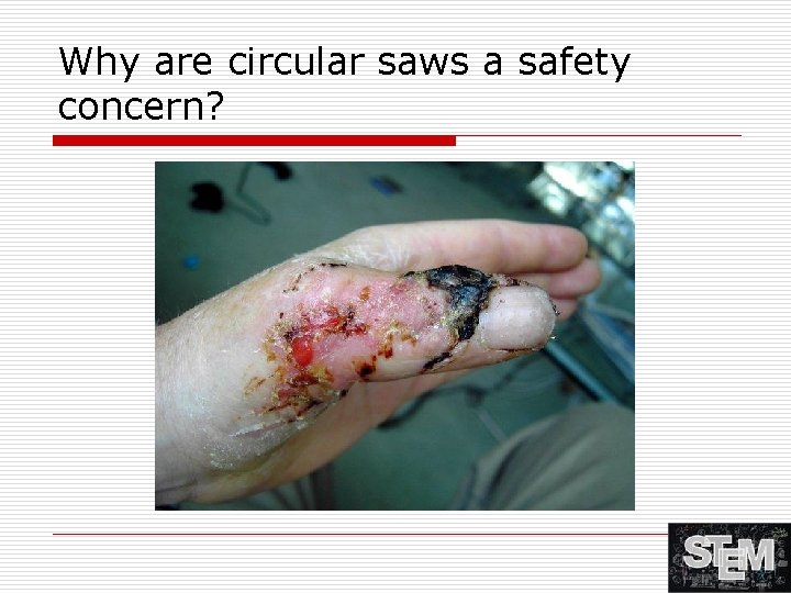 Why are circular saws a safety concern? 