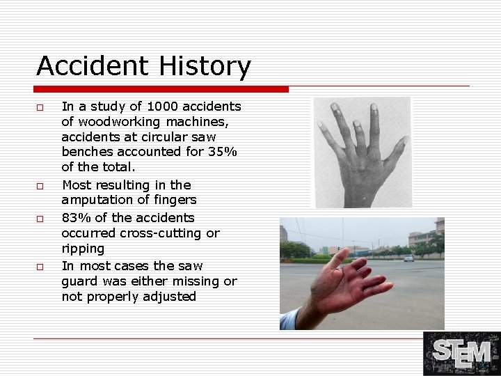 Accident History o o In a study of 1000 accidents of woodworking machines, accidents