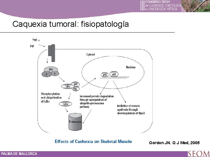 Caquexia tumoral: fisiopatología Gordon JN. Q J Med, 2005 