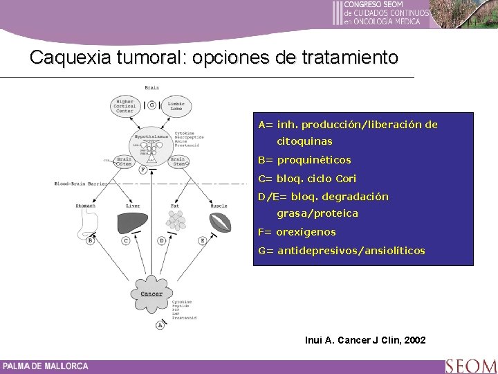 Caquexia tumoral: opciones de tratamiento A= inh. producción/liberación de citoquinas B= proquinéticos C= bloq.