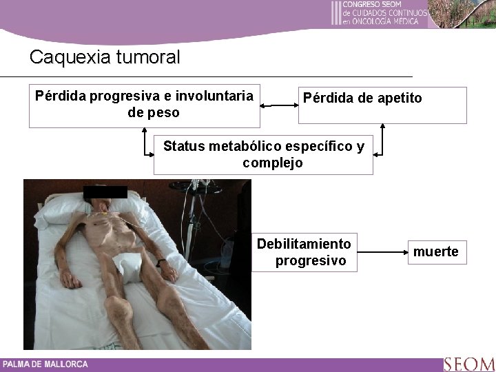 Caquexia tumoral Pérdida progresiva e involuntaria de peso Pérdida de apetito Status metabólico específico
