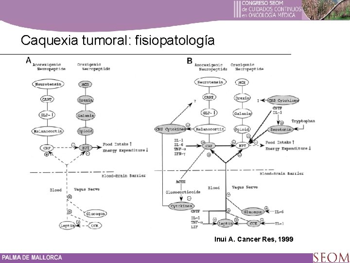 Caquexia tumoral: fisiopatología Inui A. Cancer Res, 1999 