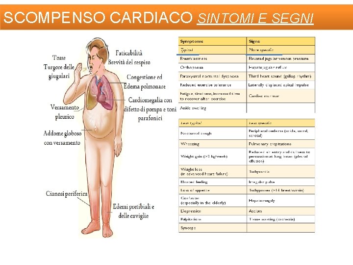 SCOMPENSO CARDIACO SINTOMI E SEGNI 