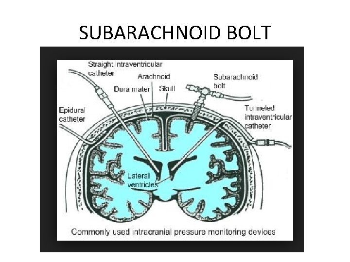 SUBARACHNOID BOLT 