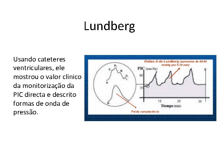 Lundberg Usando cateteres ventriculares, ele mostrou o valor clínico da monitorização da PIC directa