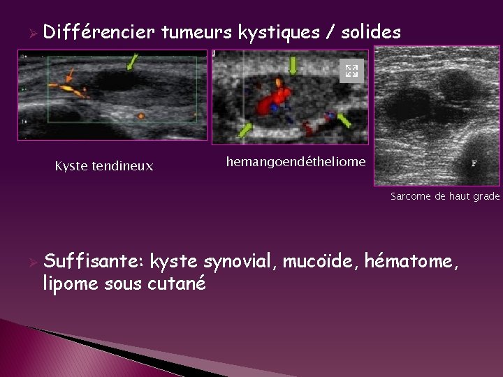 Ø Différencier Kyste tendineux tumeurs kystiques / solides hemangoendétheliome Sarcome de haut grade Ø