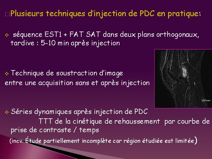 � Plusieurs v techniques d’injection de PDC en pratique: séquence EST 1 + FAT