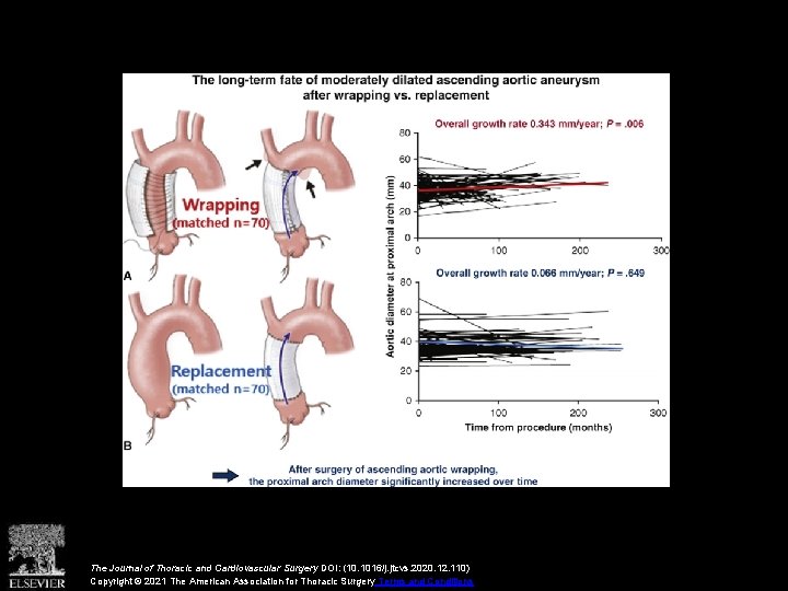 The Journal of Thoracic and Cardiovascular Surgery DOI: (10. 1016/j. jtcvs. 2020. 12. 110)