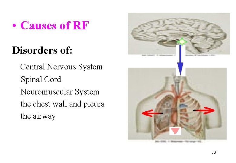  • Causes of RF Disorders of: Central Nervous System Spinal Cord Neuromuscular System
