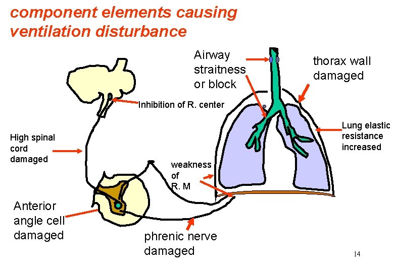 component elements causing ventilation disturbance Airway straitness or block thorax wall damaged Inhibition of