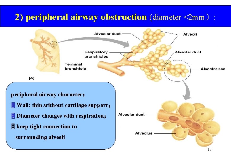 2) peripheral airway obstruction (diameter <2 mm）: peripheral airway character： Wall: thin, without cartilage